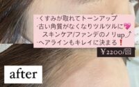 産毛ケアで夏のお顔をもっとキレイに♪【京都　久御山　中書島　伏見　まつ毛パーマ　マツパ　眉サロン】