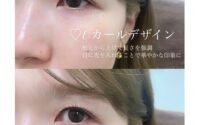 Uカールロッドデザイン