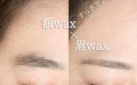 おでこWAXで艶肌に変身♪【堺/七道】