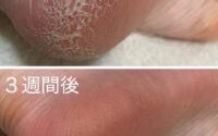 ボディコートのすごさ【Blanc近鉄四日市店 まつげパーマ 眉 まつエク メンズ】